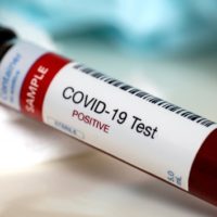istock_112720_covidbloodsample