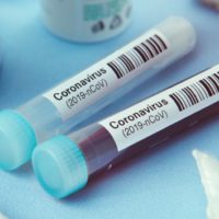 istock_11921_covidbloodsamplestubes