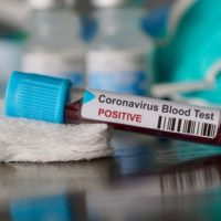 istock_12921_covidbloodsampletube