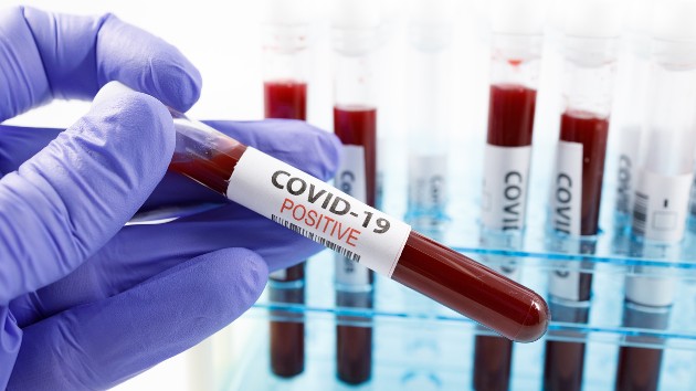 COVID-19 could become a seasonal illness like the flu, experts say - Vimarsana News
