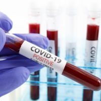 istock_41321_covidbloodsample