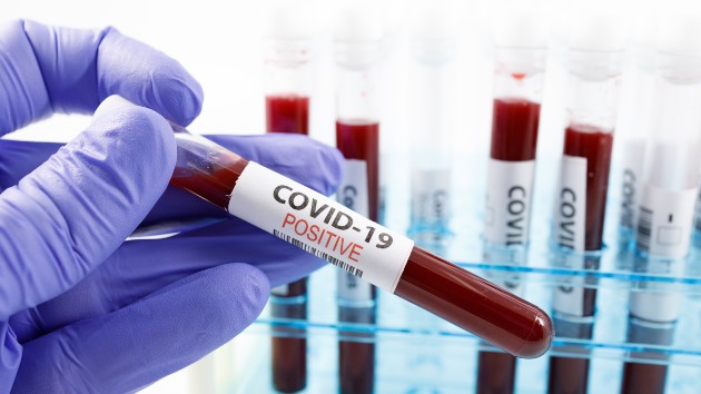 COVID-19 puts spotlight on disparities in research on women's health - Vimarsana News