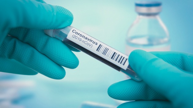 CDC finds some COVID-19 vaccine reactions actually due to anxiety - Vimarsana News