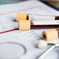 istock_61021_bloodtest