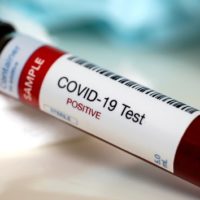 istock_71221_poscovidbloodtest