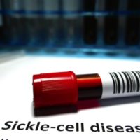 istock_092121_sicklecell