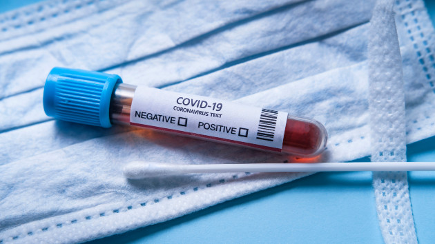 COVID-19 pandemic vs. endemic: What's the difference, and why it matters - Vimarsana News