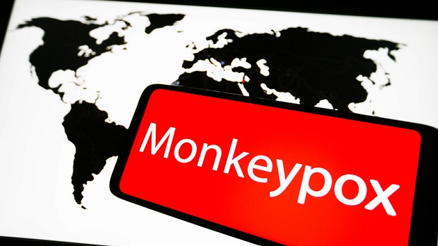 1 confirmed, 6 presumptive monkeypox cases in US, government releasing vaccines for exposed - Vimarsana News
