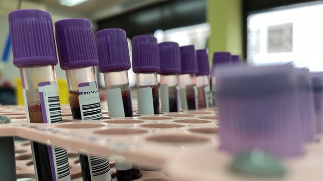 HHS to send out nearly 300,000 monkeypox vaccine doses across US in coming weeks - Vimarsana News