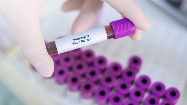 Three children in Georgia test positive for monkeypox: Officials - Vimarsana News