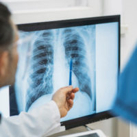gettyrf_121522_chestxray