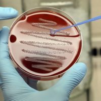 gettyimages_superbugs_02072384743
