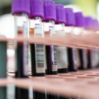 gettyrf_022023_bloodsamples791453