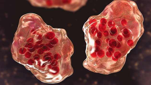 Measles outbreak in American Samoa declared public health emergency - Vimarsana News