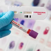 gettyrf_31522_covidtestsample122982