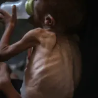 getty20gaza20hunger712368