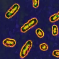 getty_plague_082625766852