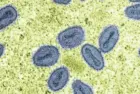 getty_mpox-virus-gty-jef-251016_1760636014247_hpmain_4x3953290