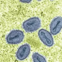 getty_mpox-virus-gty-jef-251016_1760636014247_hpmain_4x3953290