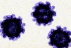 news_norovirus_112525640907