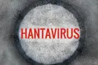 gettyrf_hantavirus_050626230952
