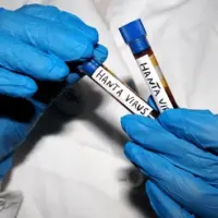 g_hantavirus_051826106731