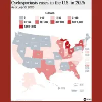 n_cyclosporiasisv04ka_1783708247935_hpembed_4x5187674