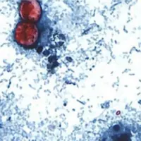 news_parasitecdc_070826457446