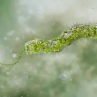 getty_flesheatingbacteria_080726888496