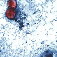 cdc_cyclosporiasis_081226384346