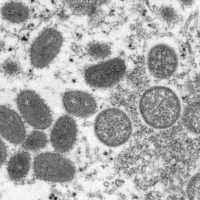 file-photo-cdc-microscopic-image-shows-monkeypox-virus-particles