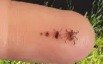 ticks