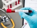 doctor-holds-test-tube-with-blood-testing-infection-with-new-coronovirus-china-s-new-virus-called-2019-ncov_159160-898