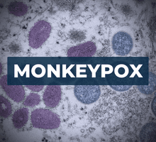 monkeypox