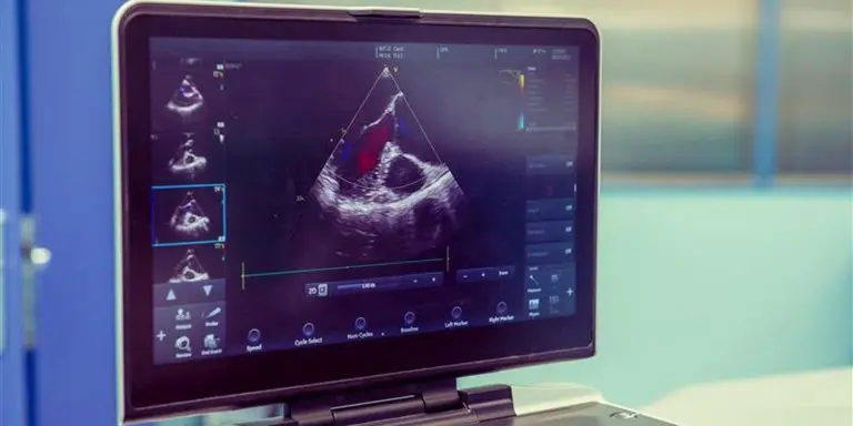 heart-ultrasound-768x38498221-1
