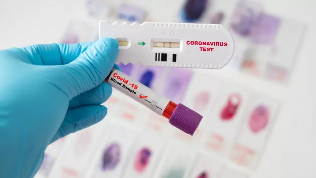 gettyrf_31522_covidtestsample369173