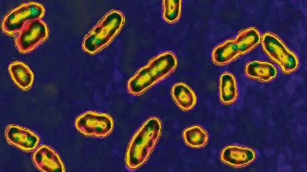 getty_plague_082625485757