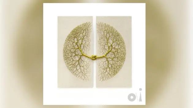 m_beenundone_010526437512