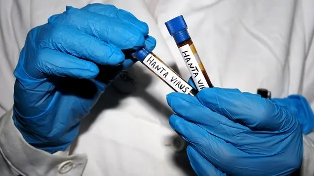 g_hantavirus_05182693479