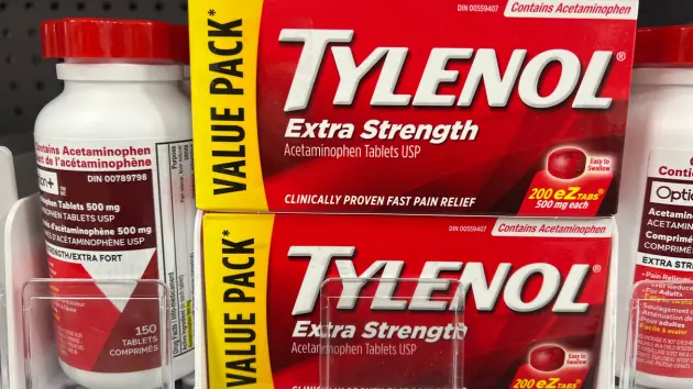 getty_tylenol_3626817677