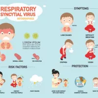 rsvrespiratory-syncytial-virus-infographicvector-illustration