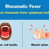 rheumatic-fever-2