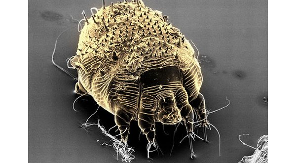 wireready_01-22-2018-22-58-07_09976_photolibrary_rf_photo_of_scabies_mite