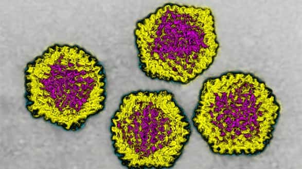 102718_getty_adenovirus