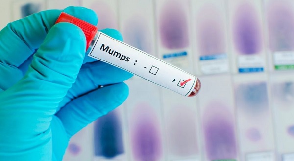 wireready_03-13-2019-16-26-02_08145_mumps