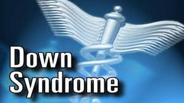wireready_03-28-2019-16-10-02_08488_downsyndrome