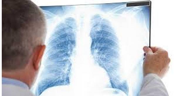 wireready_06-05-2019-16-54-02_09896_legionnairesdisease