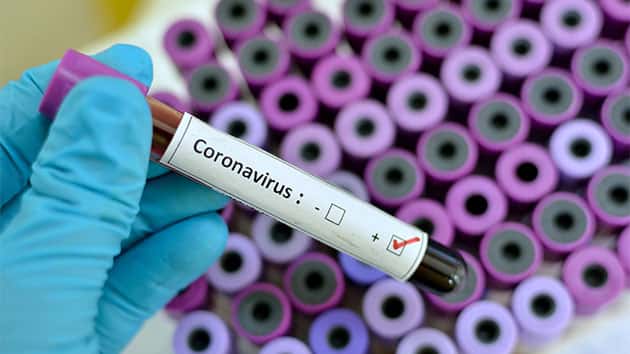 istock_020220_coronavirus