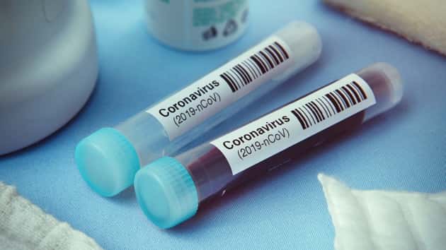 istock_030920_coronavirusstlouis