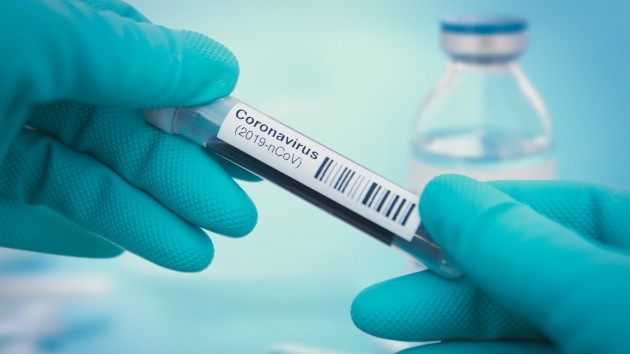 istock_31920_covidtestsample